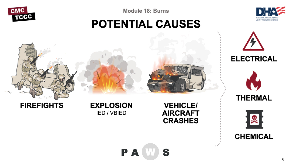 Module 18: Burns