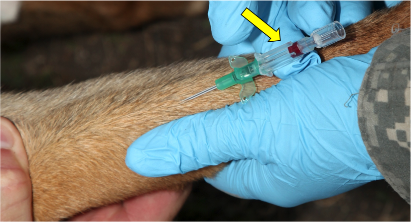 Figure 26.  Pierce the vein with the catheter
