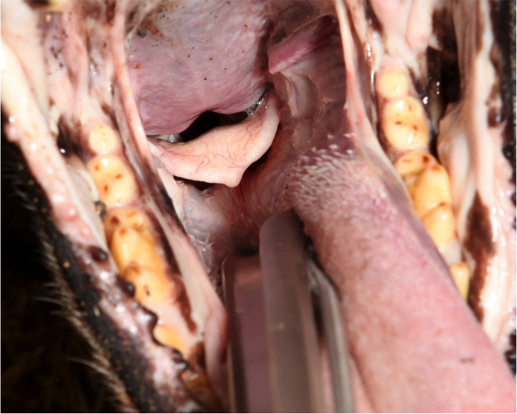 Figure 4.  Push downward with the laryngoscope blade to move the epiglottis and visualize the trachea