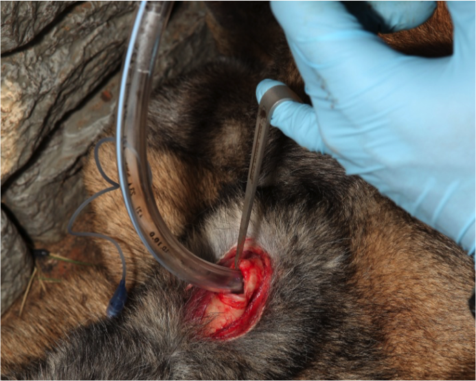 Figure 16.   Insert tracheostomy tube (ideal) or endotracheal tube through the incision and direct the distal opening down the trachea.