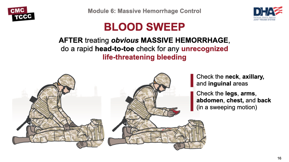 arterial bleeding control