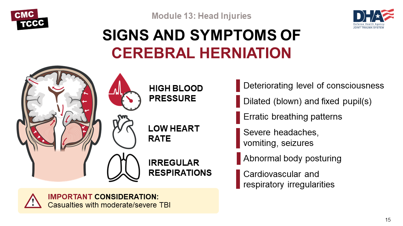 Module 20 Head Injuries