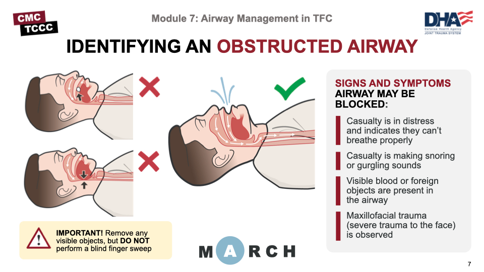 Module 7: Airway Management in TFC