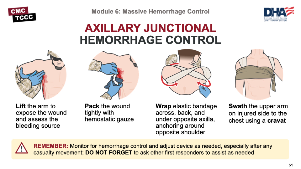 Module 6: Massive Hemorrhage Control