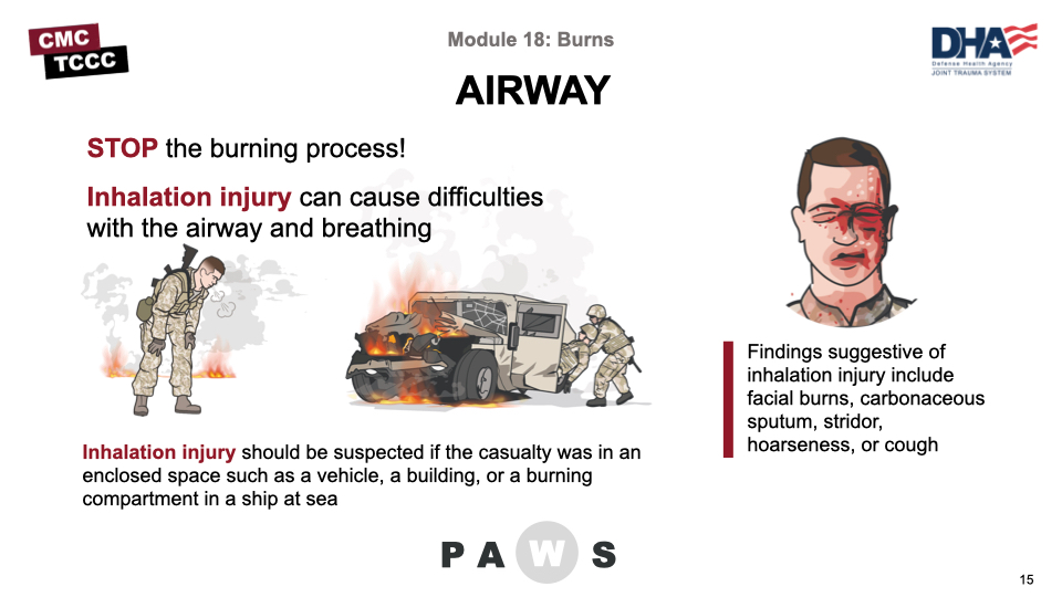 Module 18: Burns