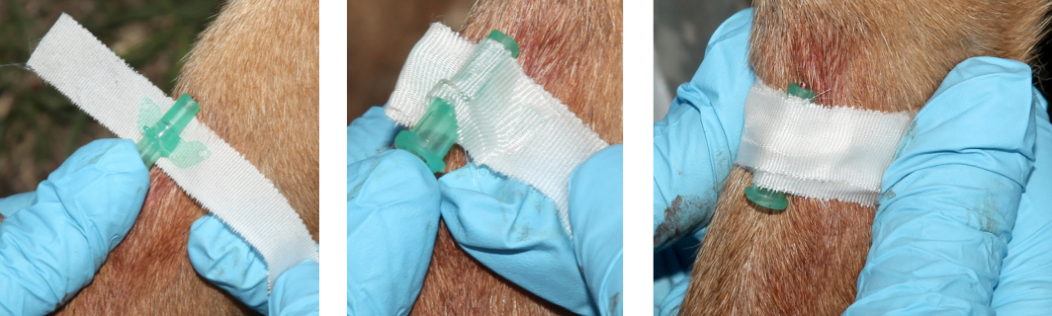 Figure 30.  Secure the catheter to the limb with tape
